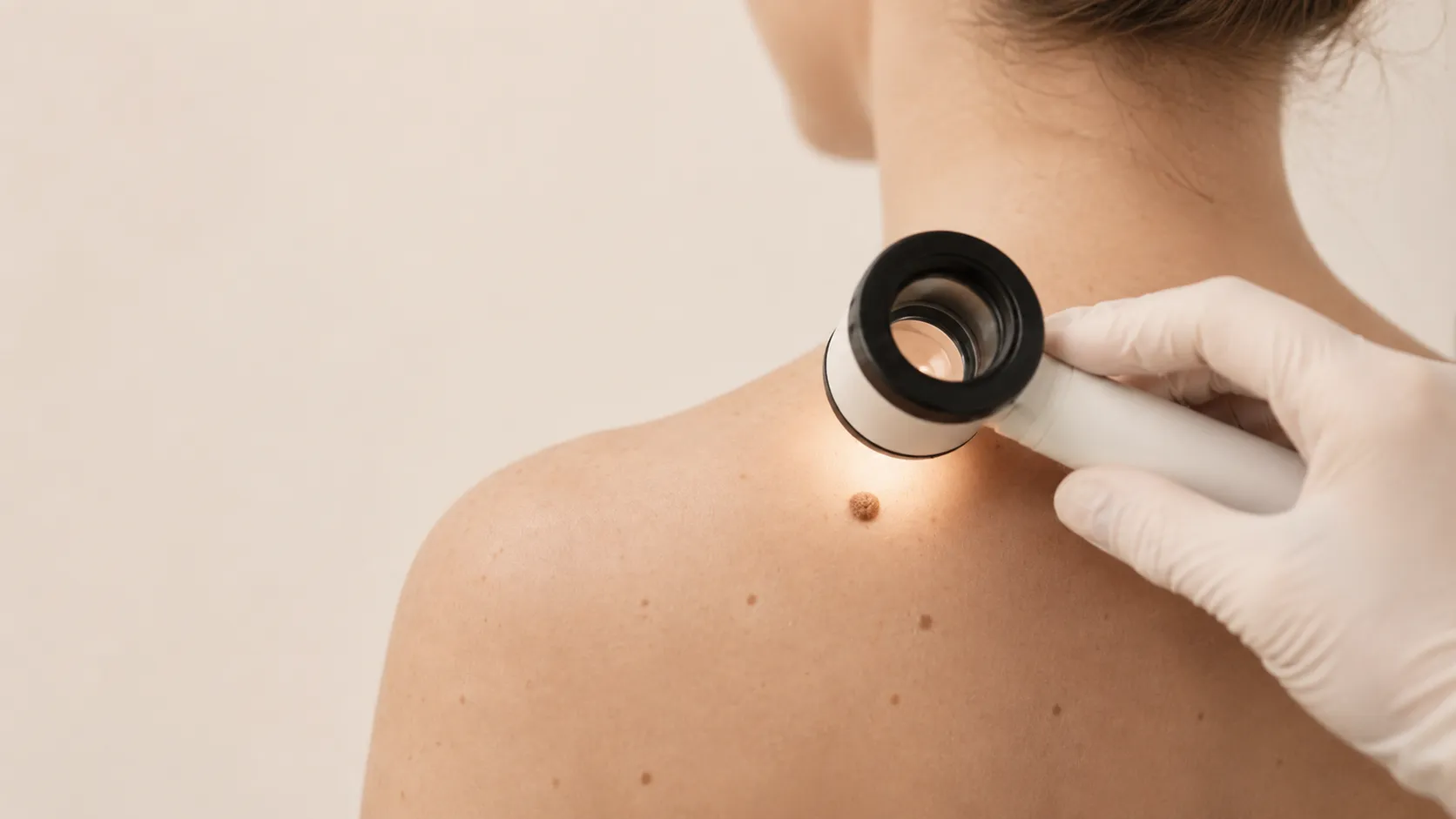 Dermatoskopski pregled znamenj